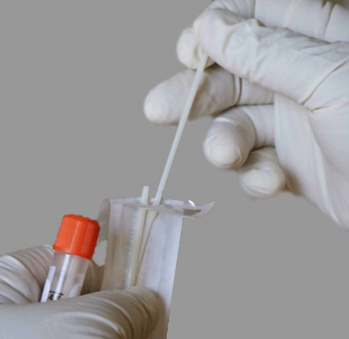 Test de detección de anticuerpos post infección